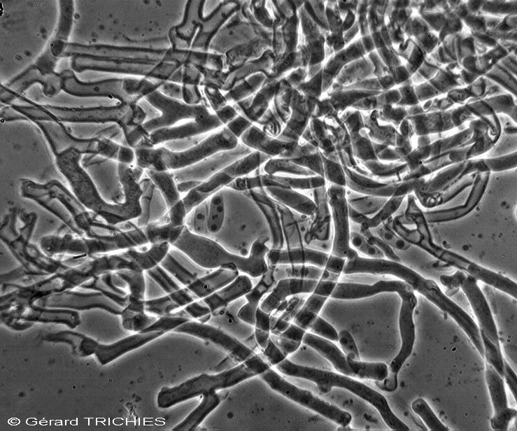 Una crosta da determinare - foto 3627 (Mutatoderma mutatum)